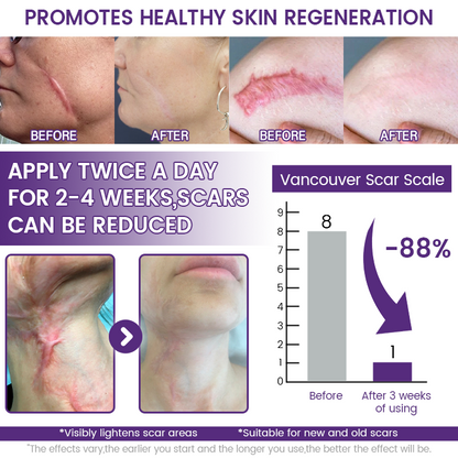 SEAGRIL® Stem Cell Scar Gel