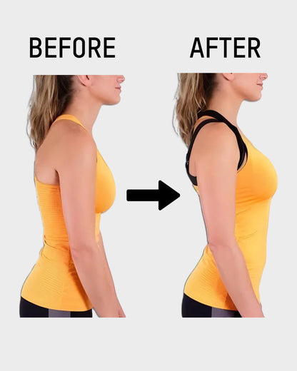 Wire-Free Posture-Correcting Bra – Crossed Straps & Front Closure