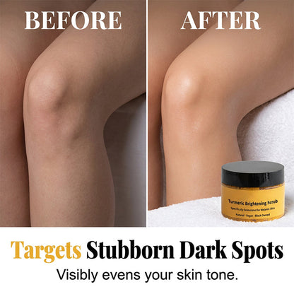 👩‍⚕️Turmeric Body Scrub – Gentle Exfoliation & Dark Spot Corrector